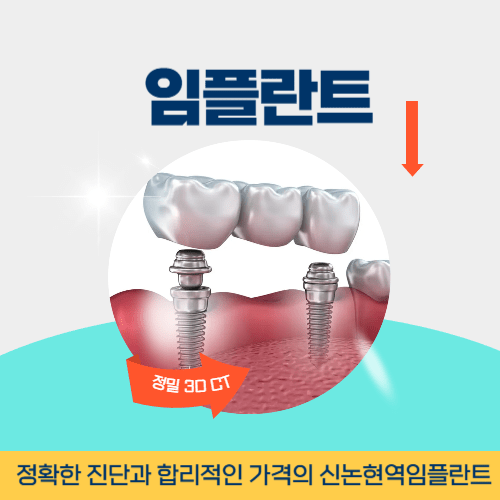 천안치과 천안시 치과 임플란트
