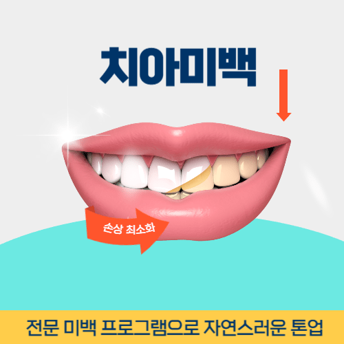 천안치과 천안시 치과 치아미백